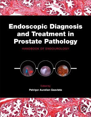 Endoscopic Diagnosis and Treatment in Prostate Pathology