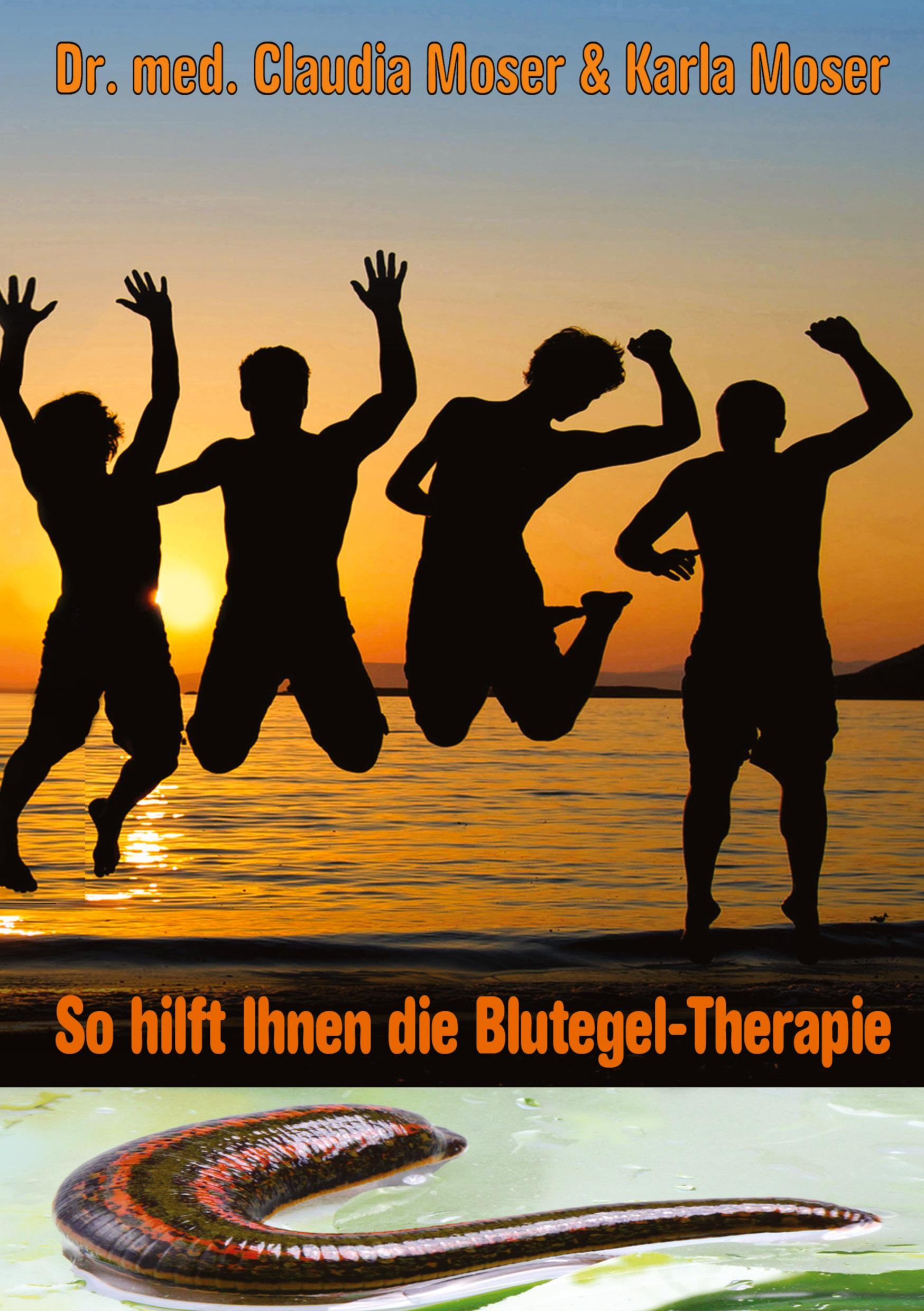 So hilft ihnen die Blutegeltherapie