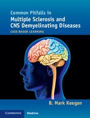 Common Pitfalls in Multiple Sclerosis and CNS Demyelinating Diseases