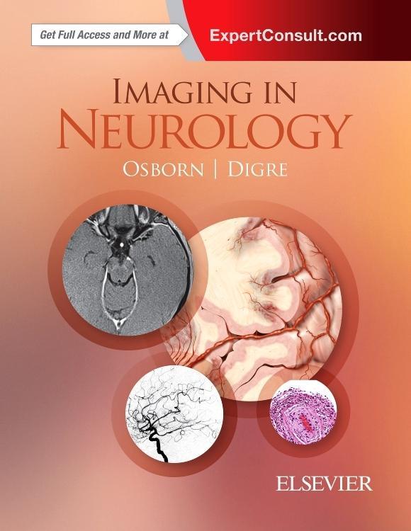 Imaging in Neurology