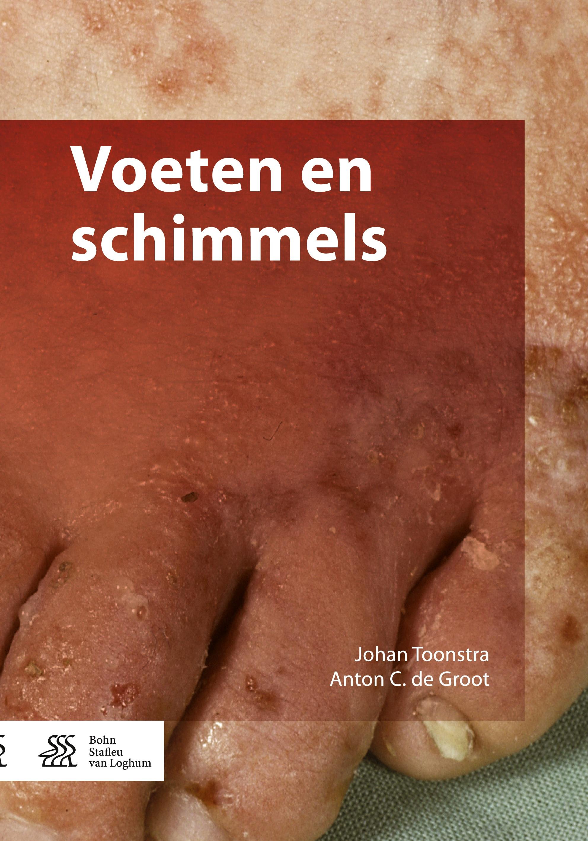 Voeten en schimmels