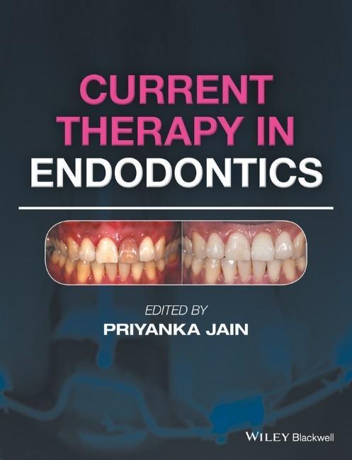 Current Therapy in Endodontics