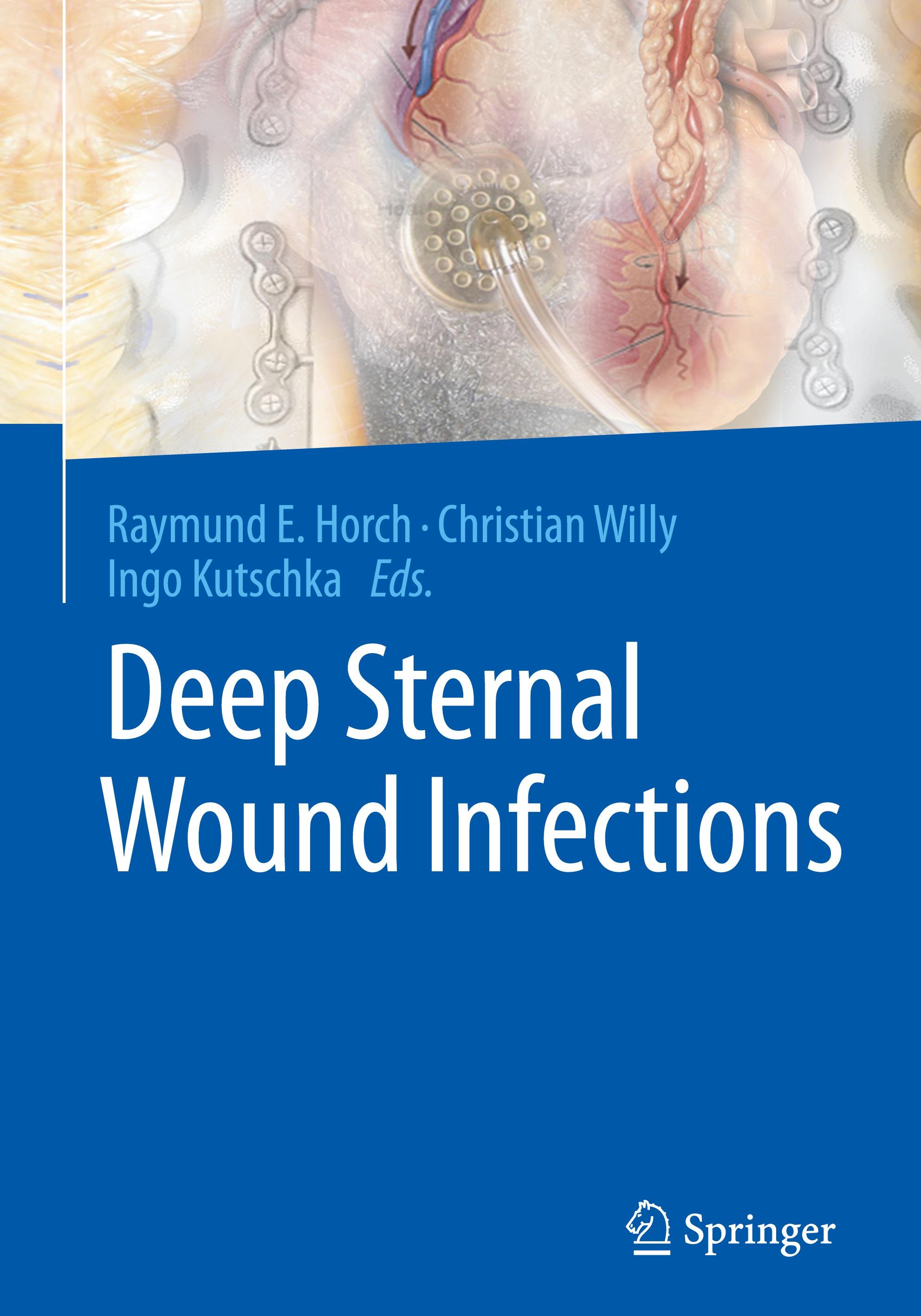 Deep Sternal Wound Infections