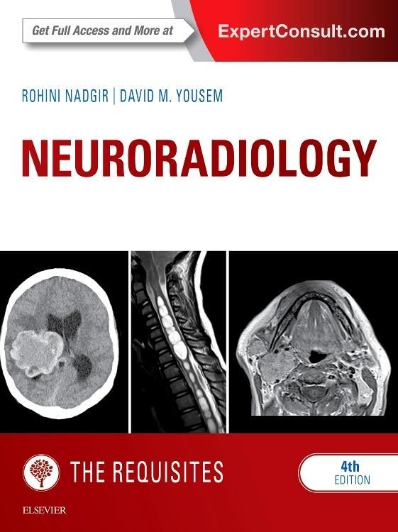 Neuroradiology: The Requisites