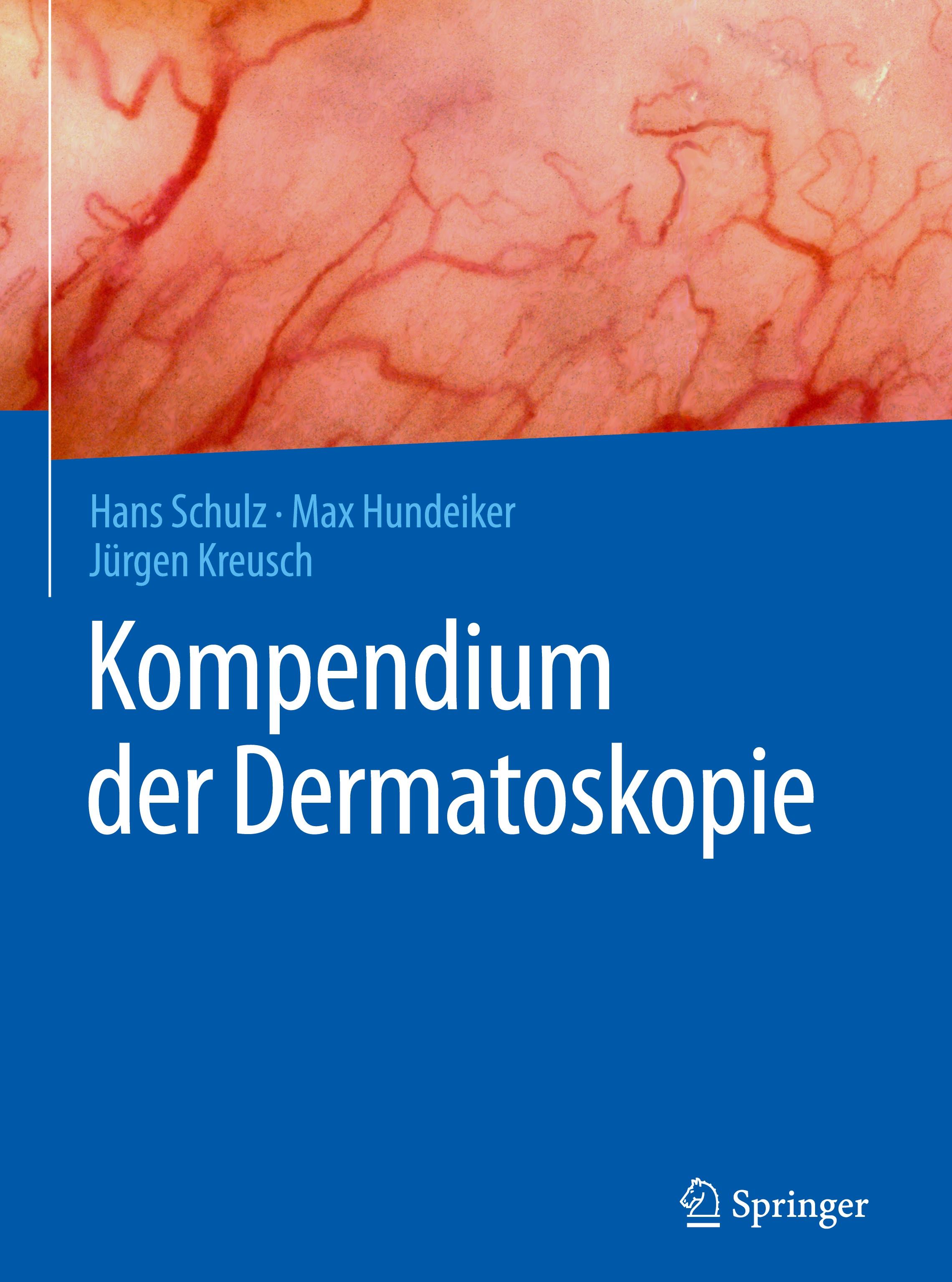 Kompendium der Dermatoskopie