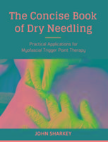 The Concise Book of Dry Needling