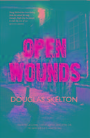 Open Wounds