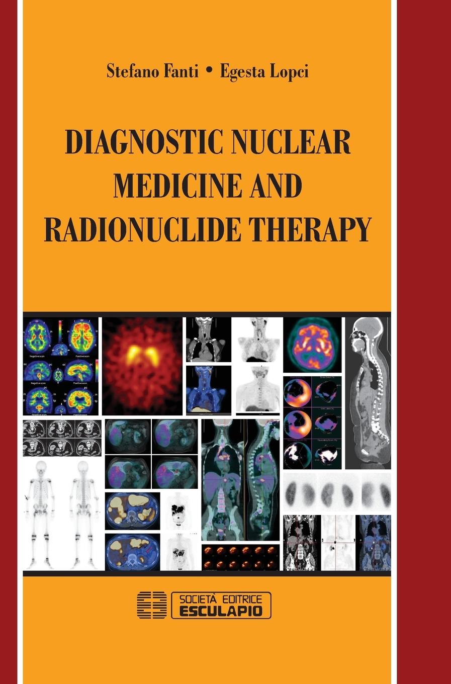 Diagnostic Nuclear Medicine and Radionuclide Therapy