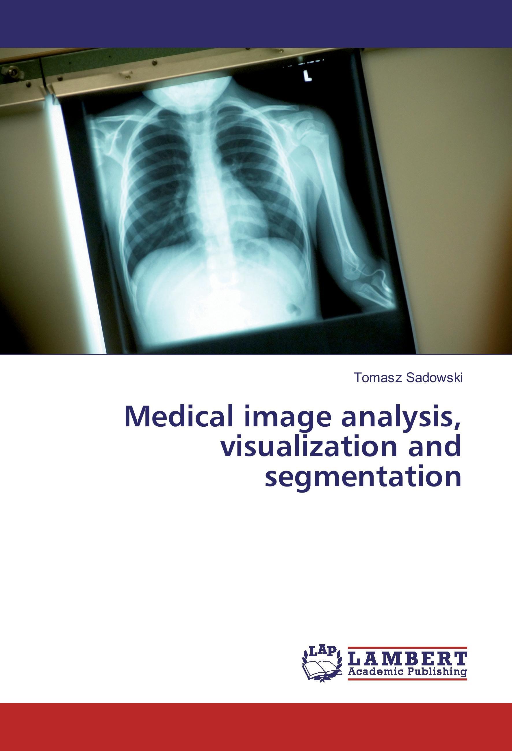 Medical image analysis, visualization and segmentation