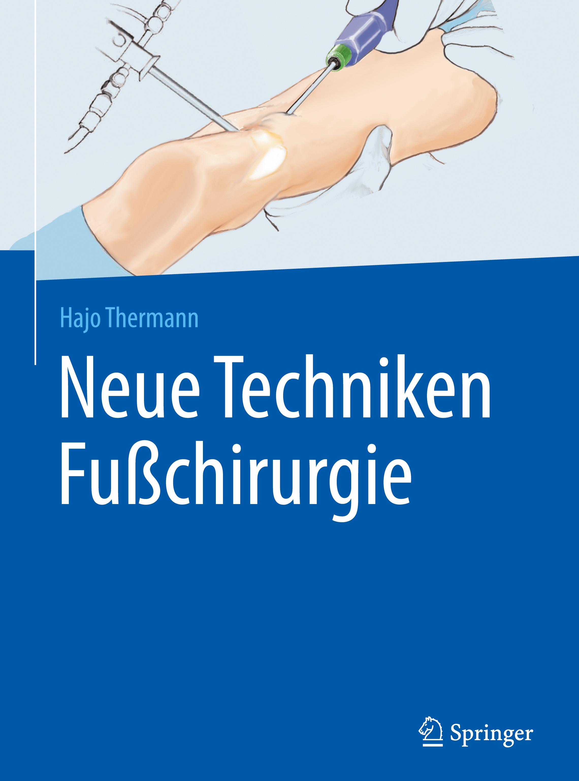 Neue Techniken Fußchirurgie