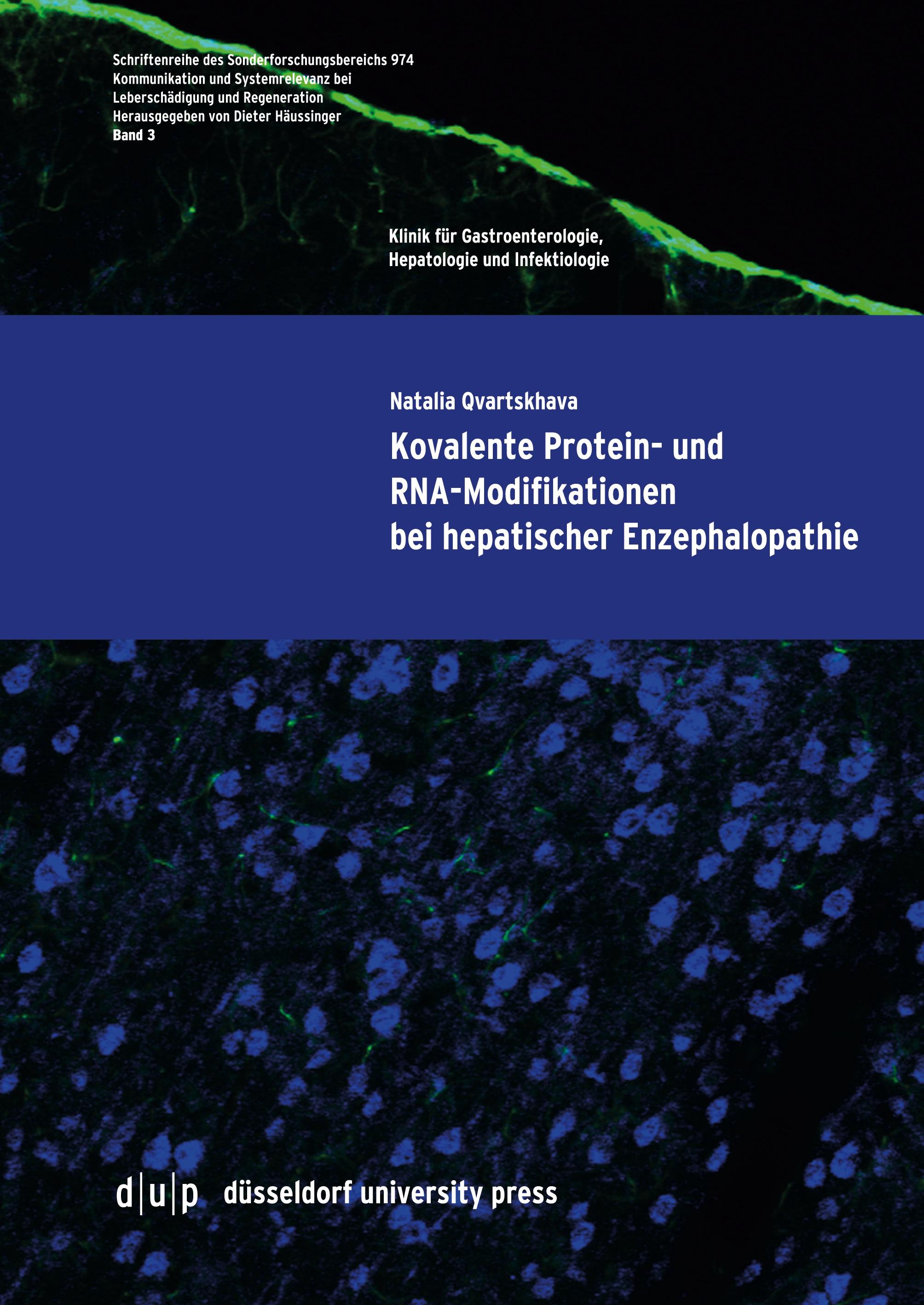 Kovalente Protein- und RNA-Modifikationen bei hepatischer Enzephalopathie