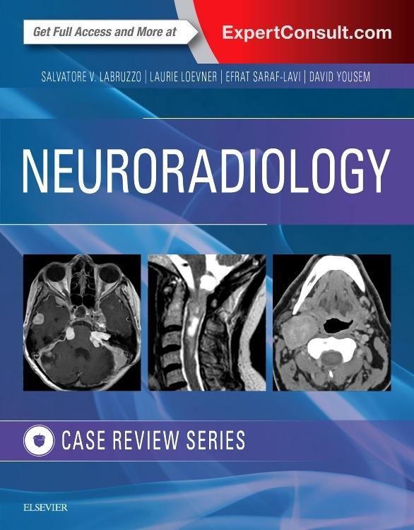 Neuroradiology Imaging Case Review