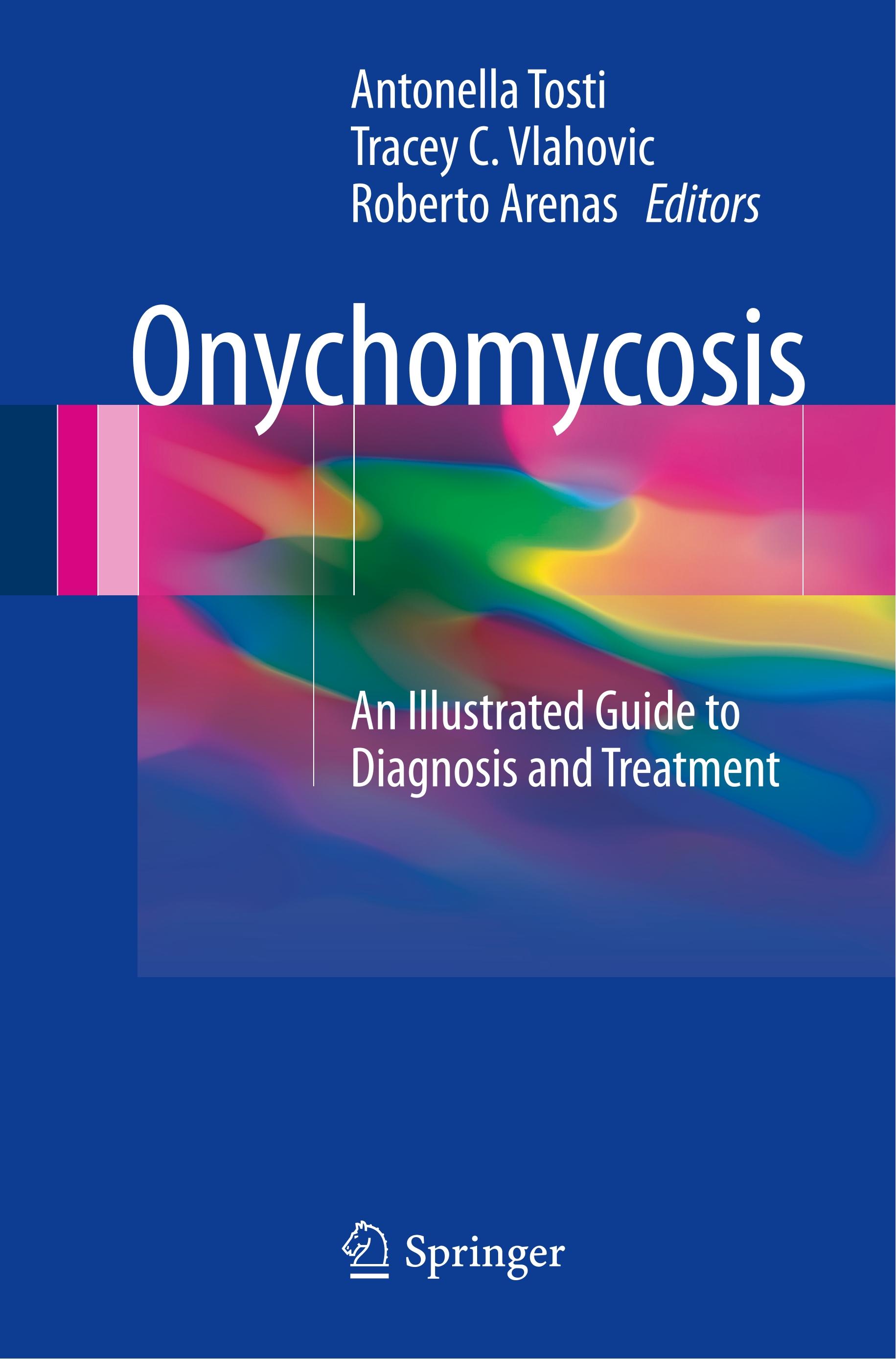 Onychomycosis