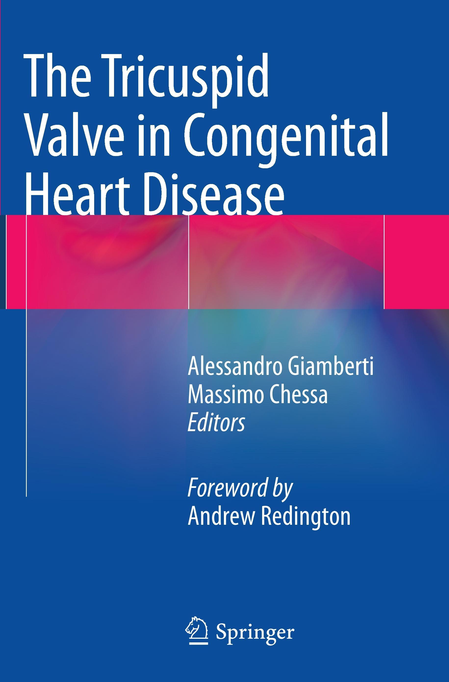 The Tricuspid Valve in Congenital Heart Disease