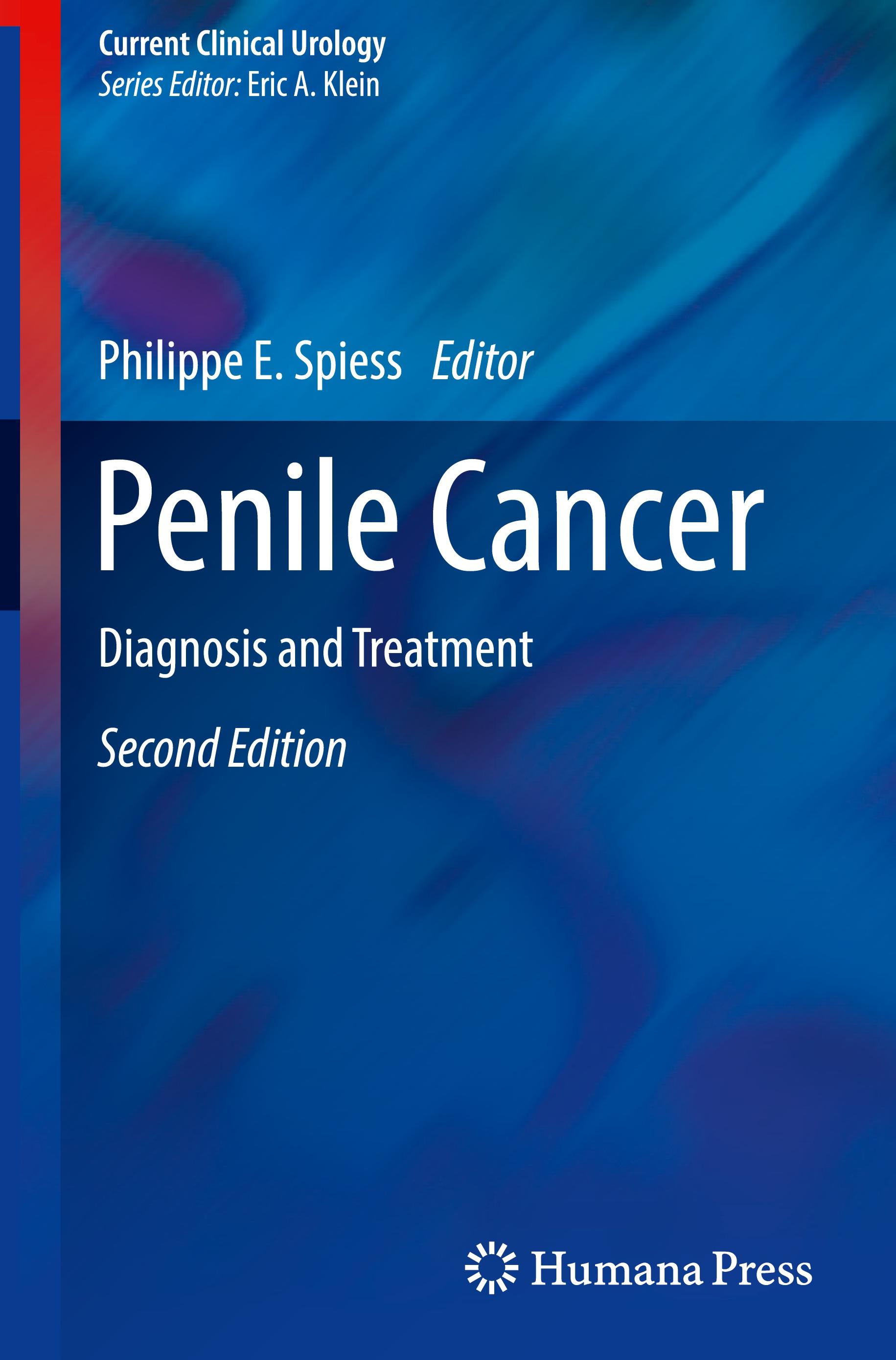 Penile Cancer