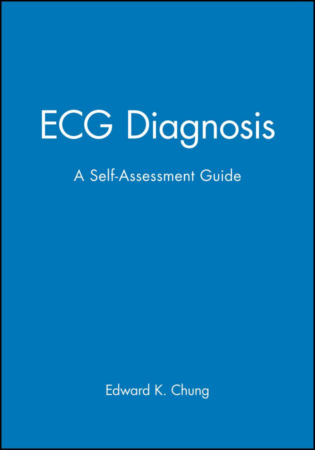 ECG Diagnosis