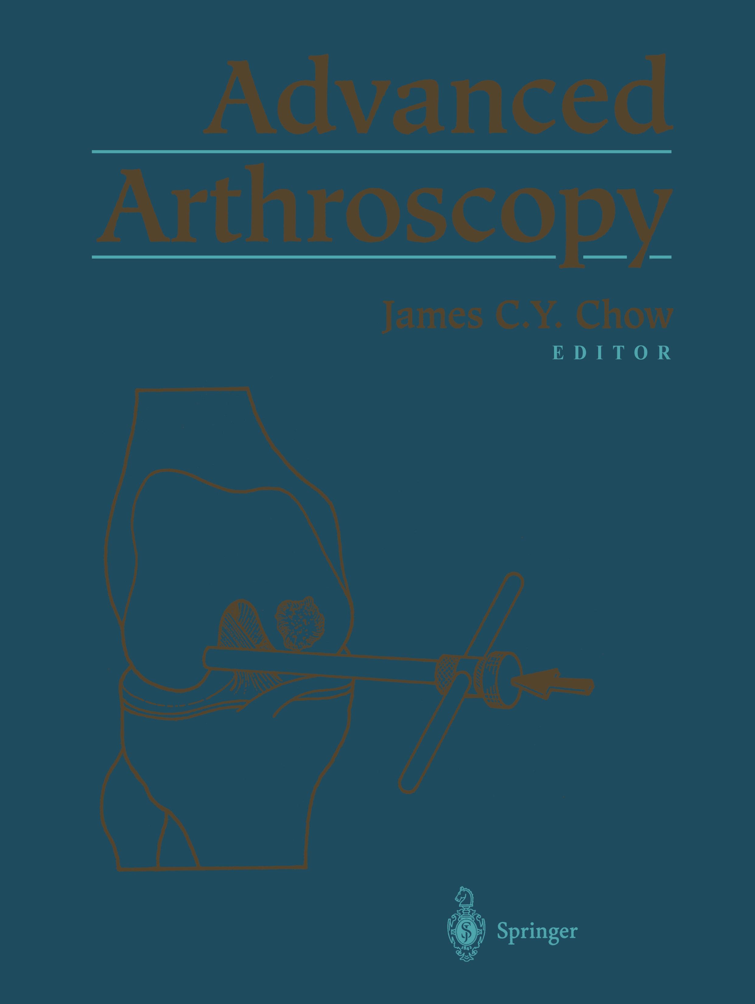 Advanced Arthroscopy