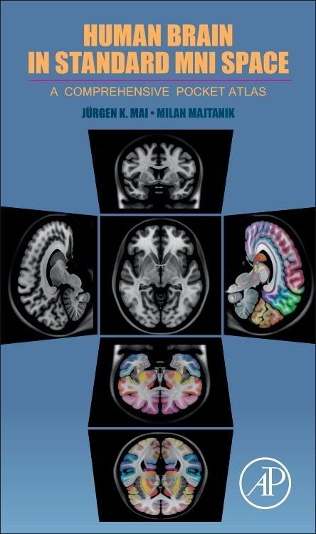 Human Brain in Standard Mni Space