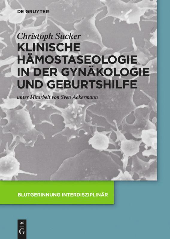 Klinische Hämostaseologie in der Gynäkologie und Geburtshilfe