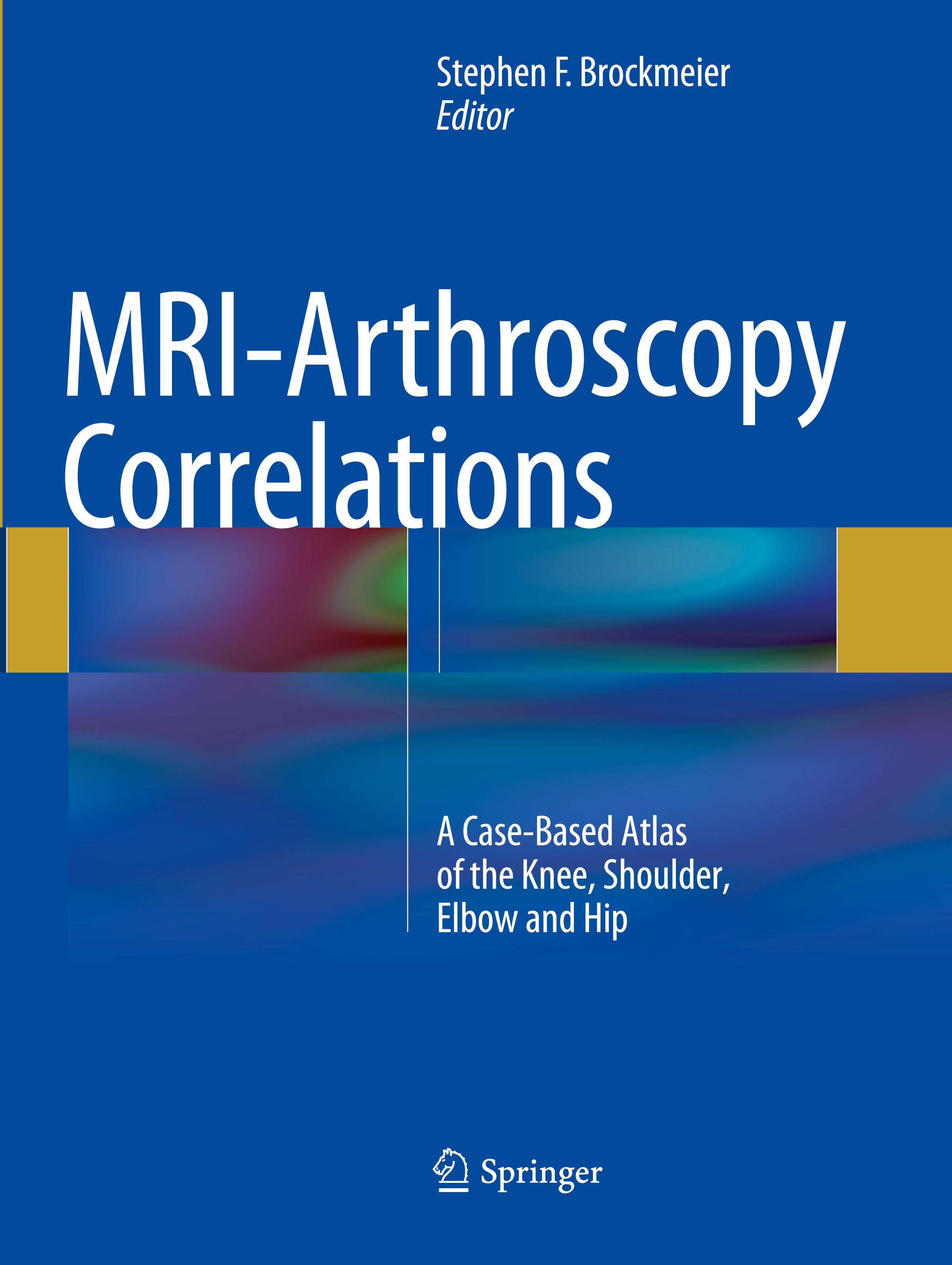 MRI-Arthroscopy Correlations