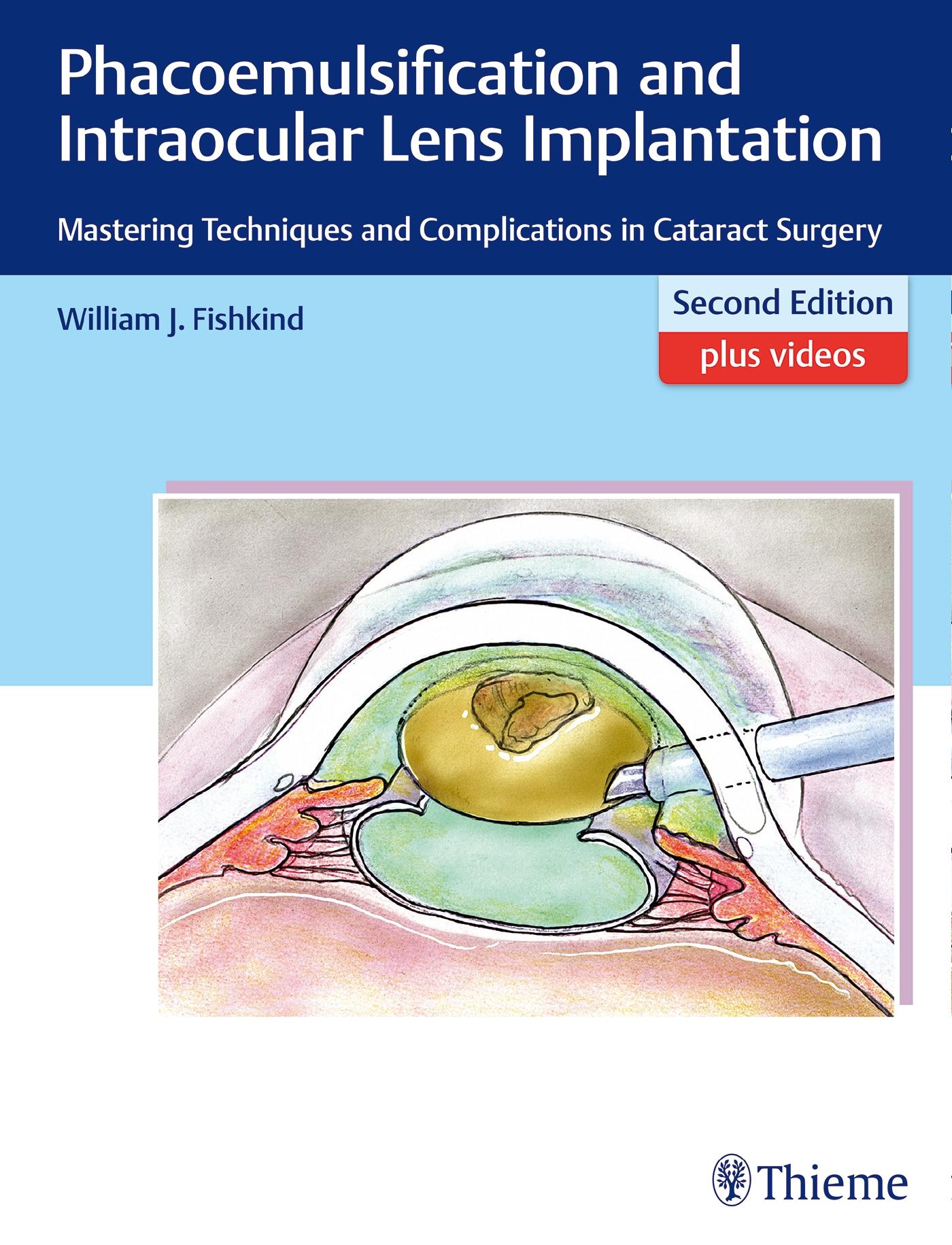 Phacoemulsification and Intraocular Lens Implantation