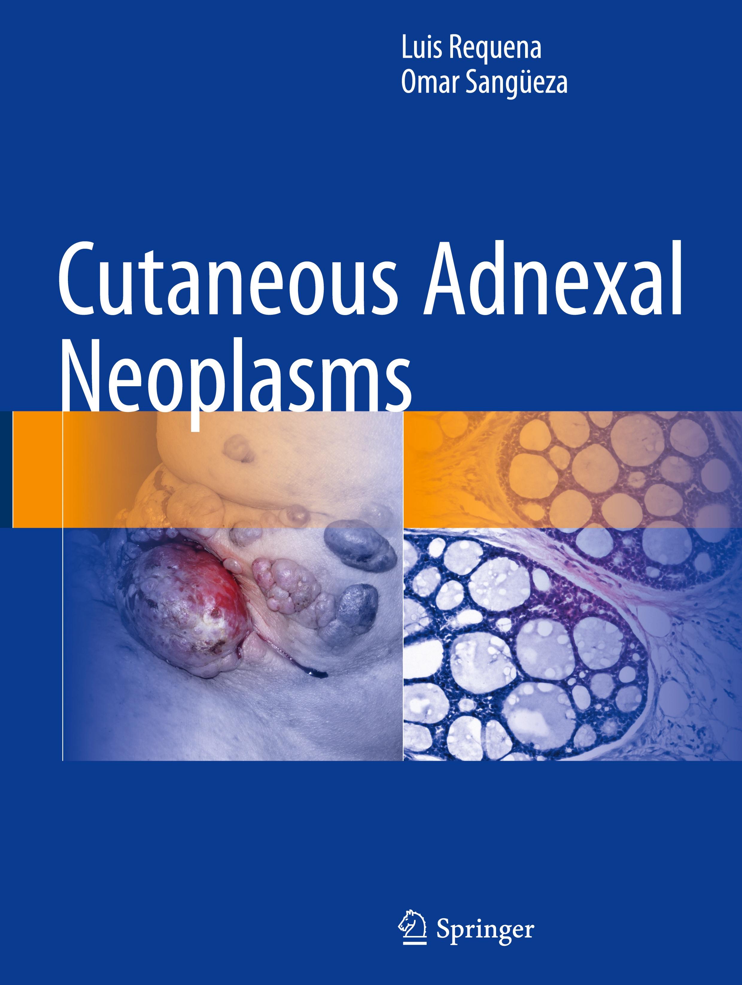 Cutaneous Adnexal Neoplasms