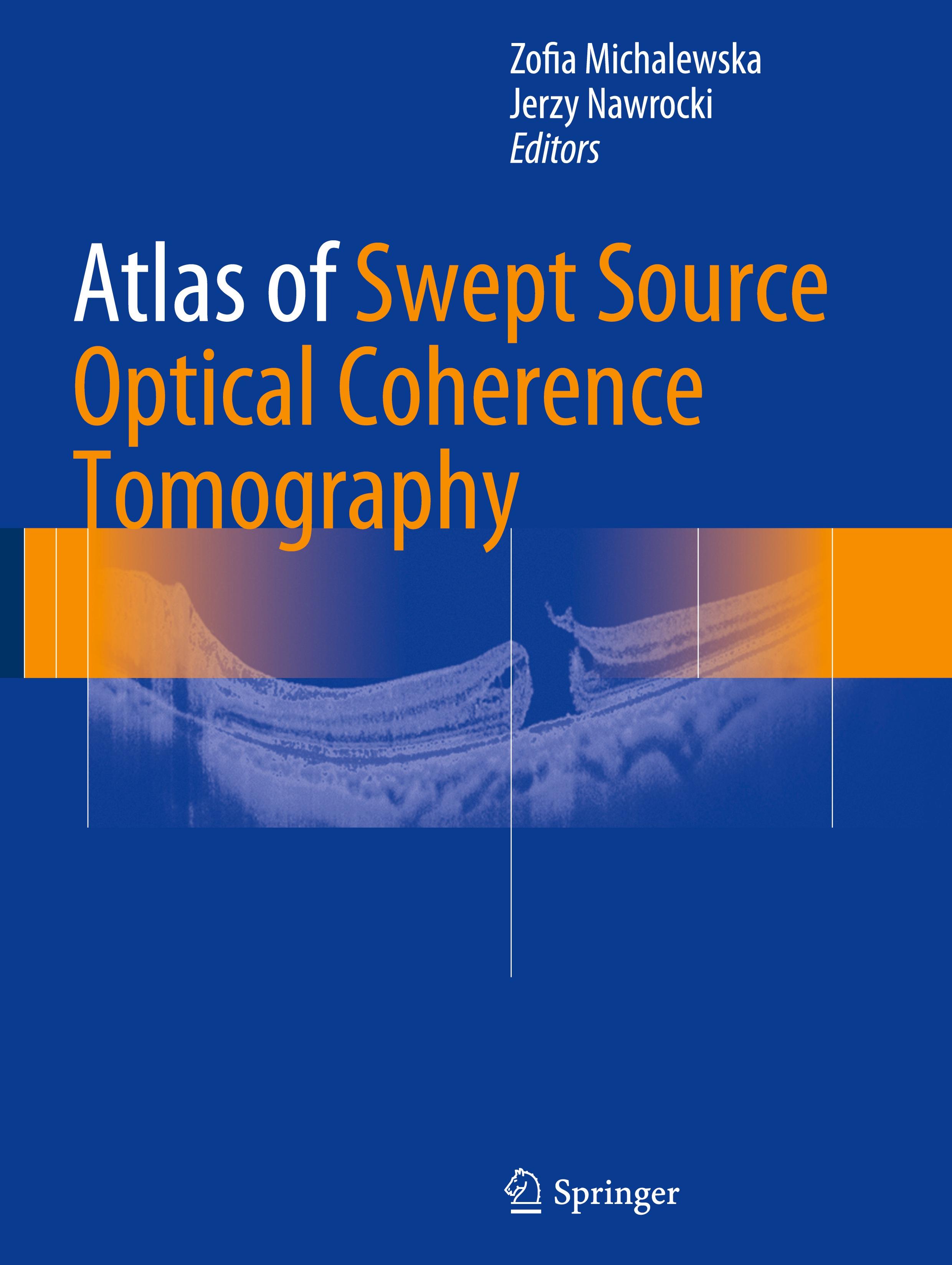 Atlas of Swept Source Optical Coherence Tomography