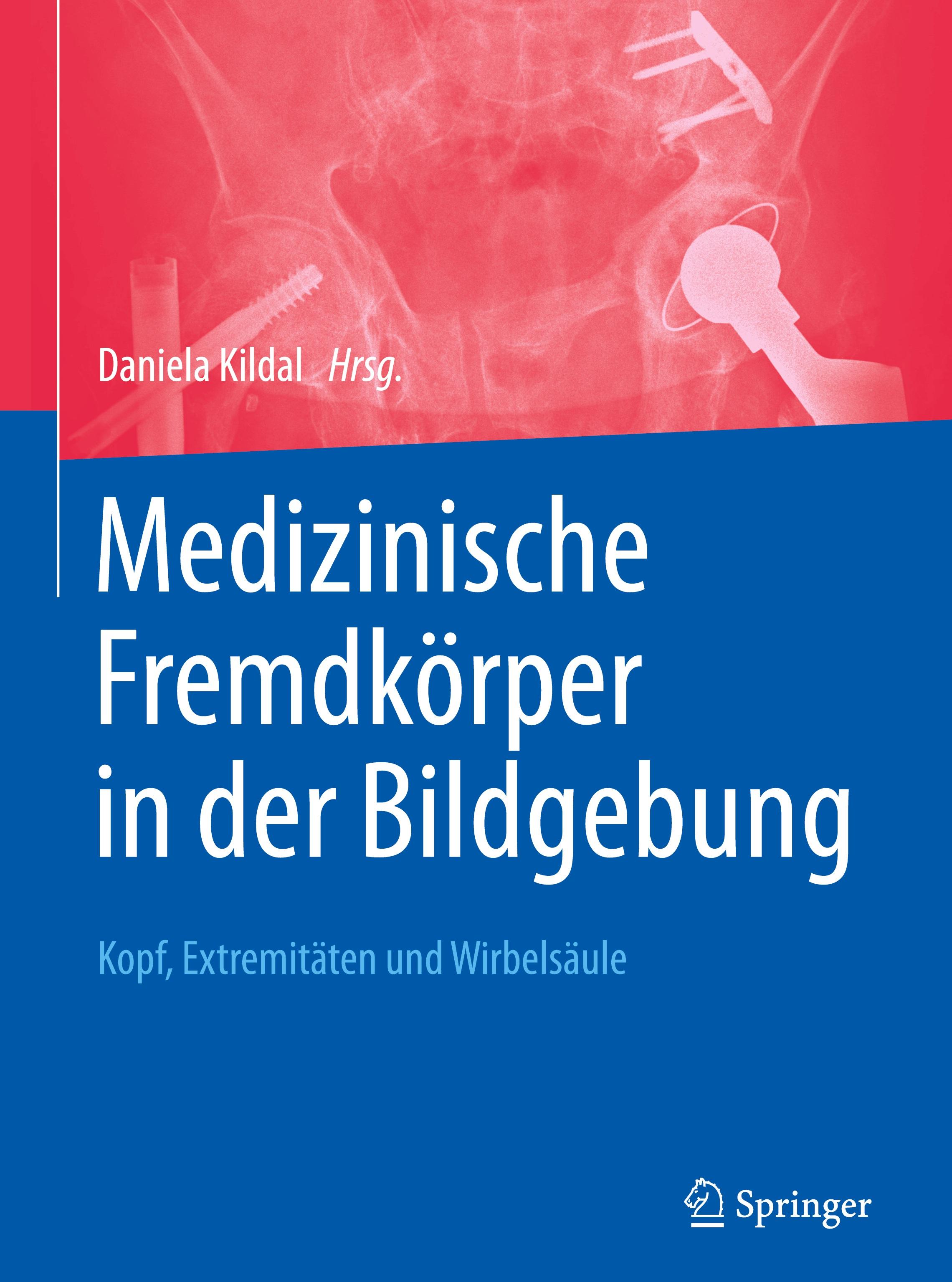 Medizinische Fremdkörper in der Bildgebung