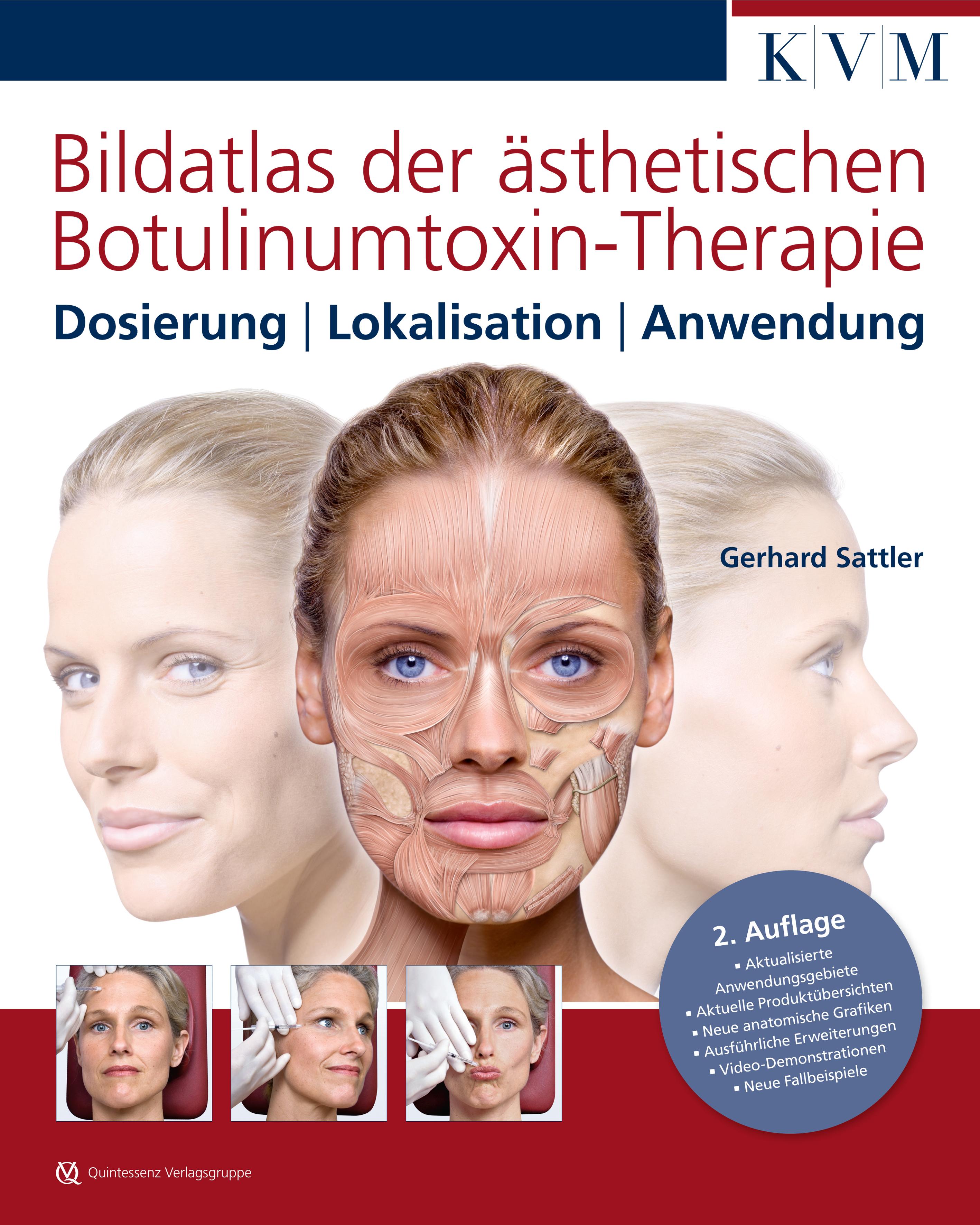 Bildatlas der ästhetischen Botulinumtoxin-Therapie