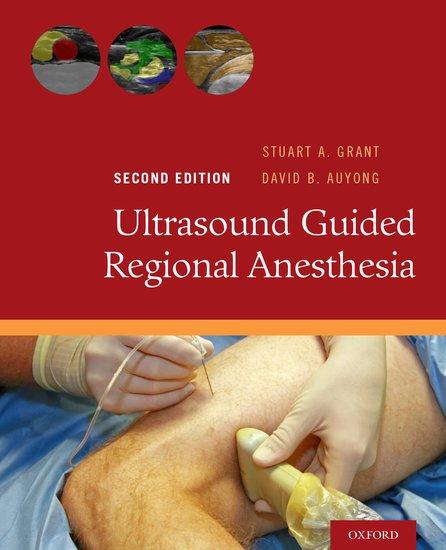 Ultrasound Guided Regional Anesthesia