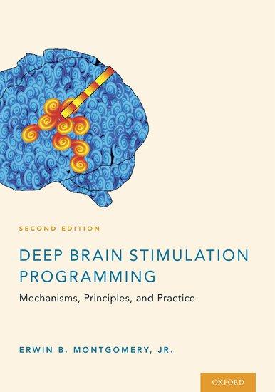 Deep Brain Stimulation Programming