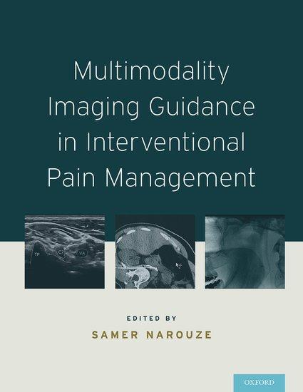 Multimodality Imaging Guidance in Interventional Pain Management