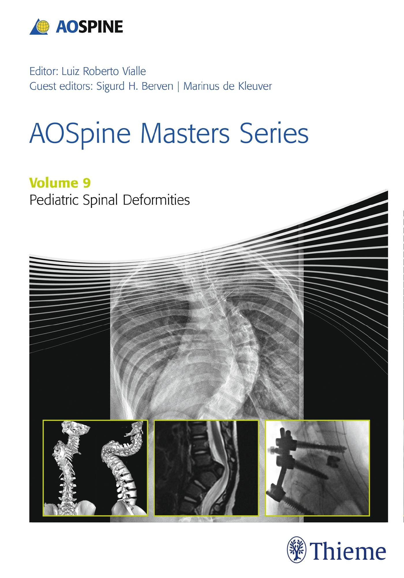 Aospine Masters Series, Volume 9: Pediatric Spinal Deformities