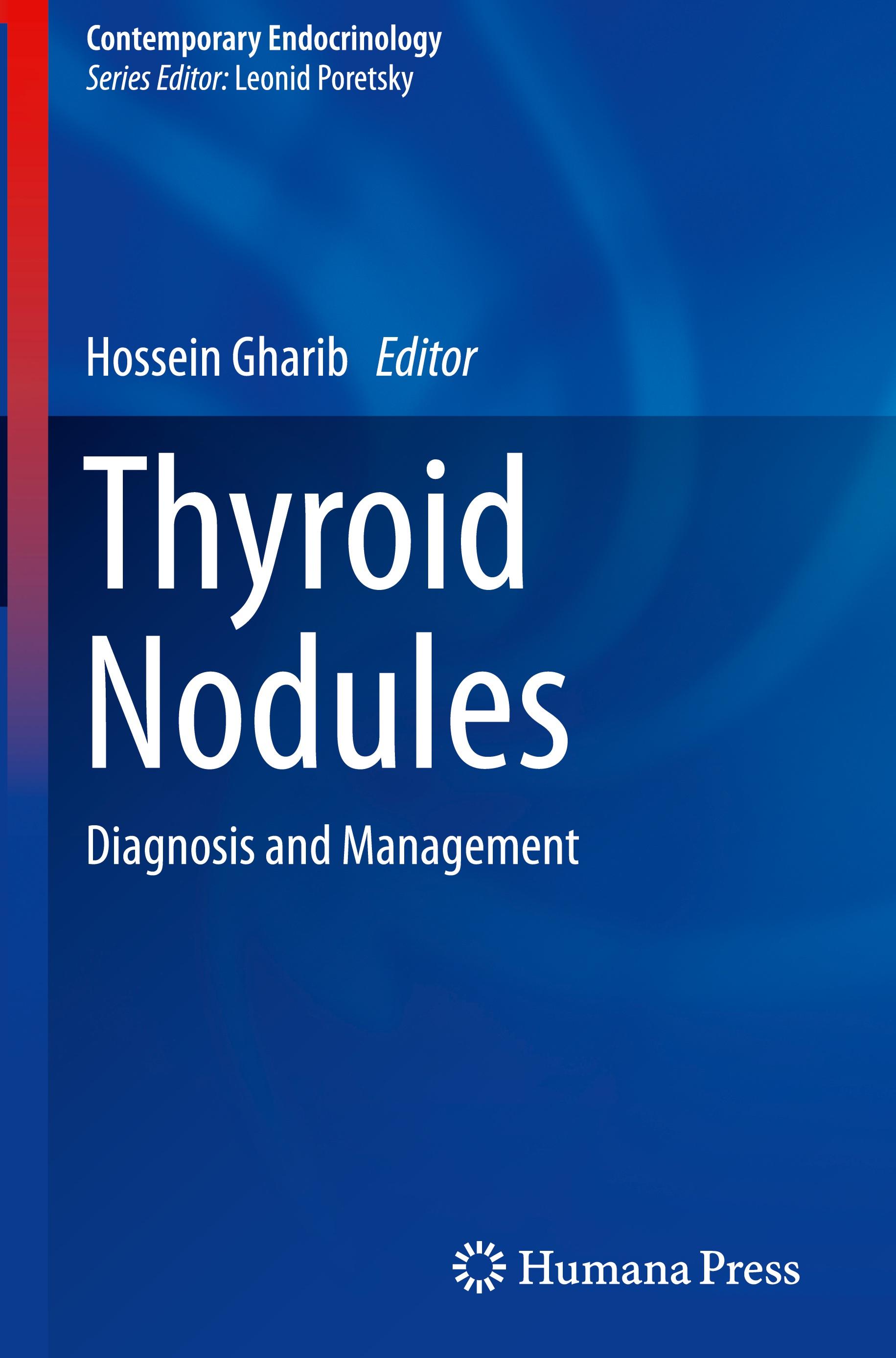 Thyroid Nodules