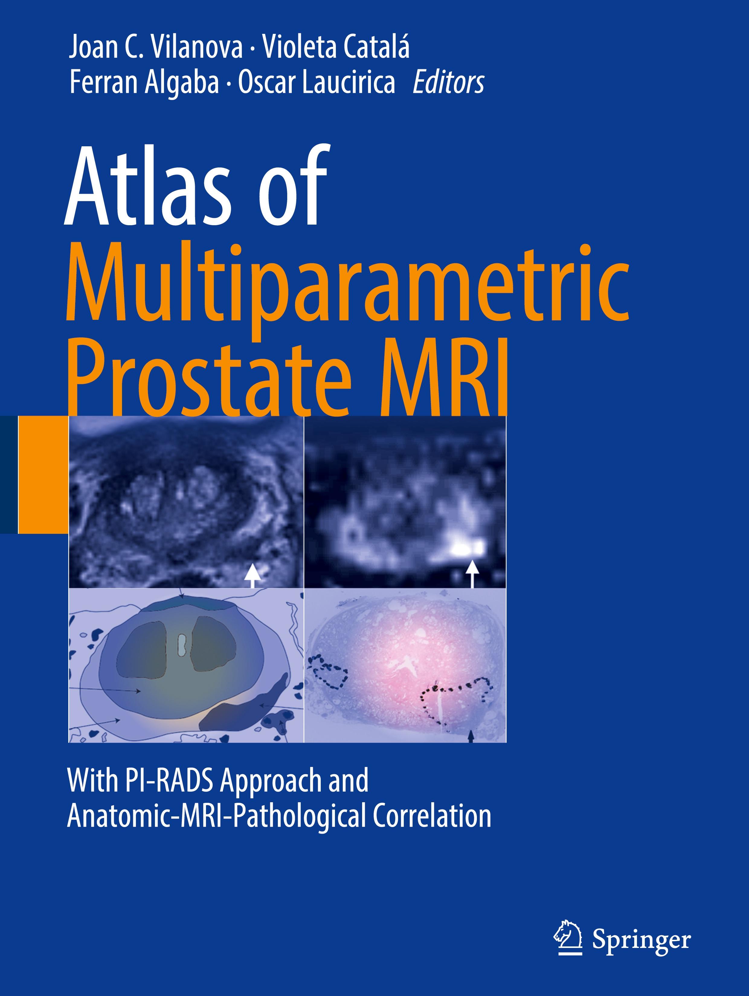 Atlas of Multiparametric Prostate MRI