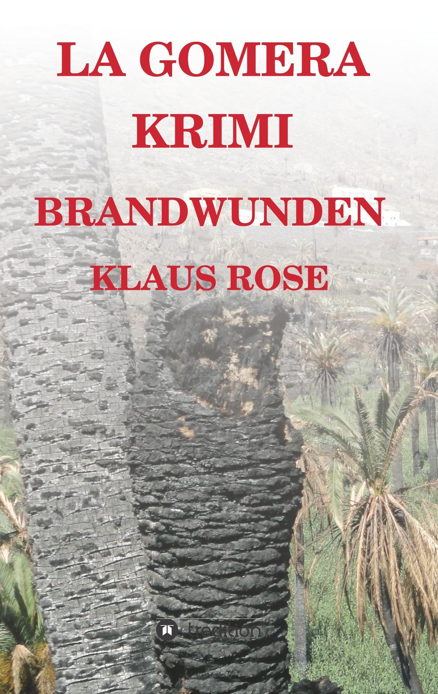 Brandwunden