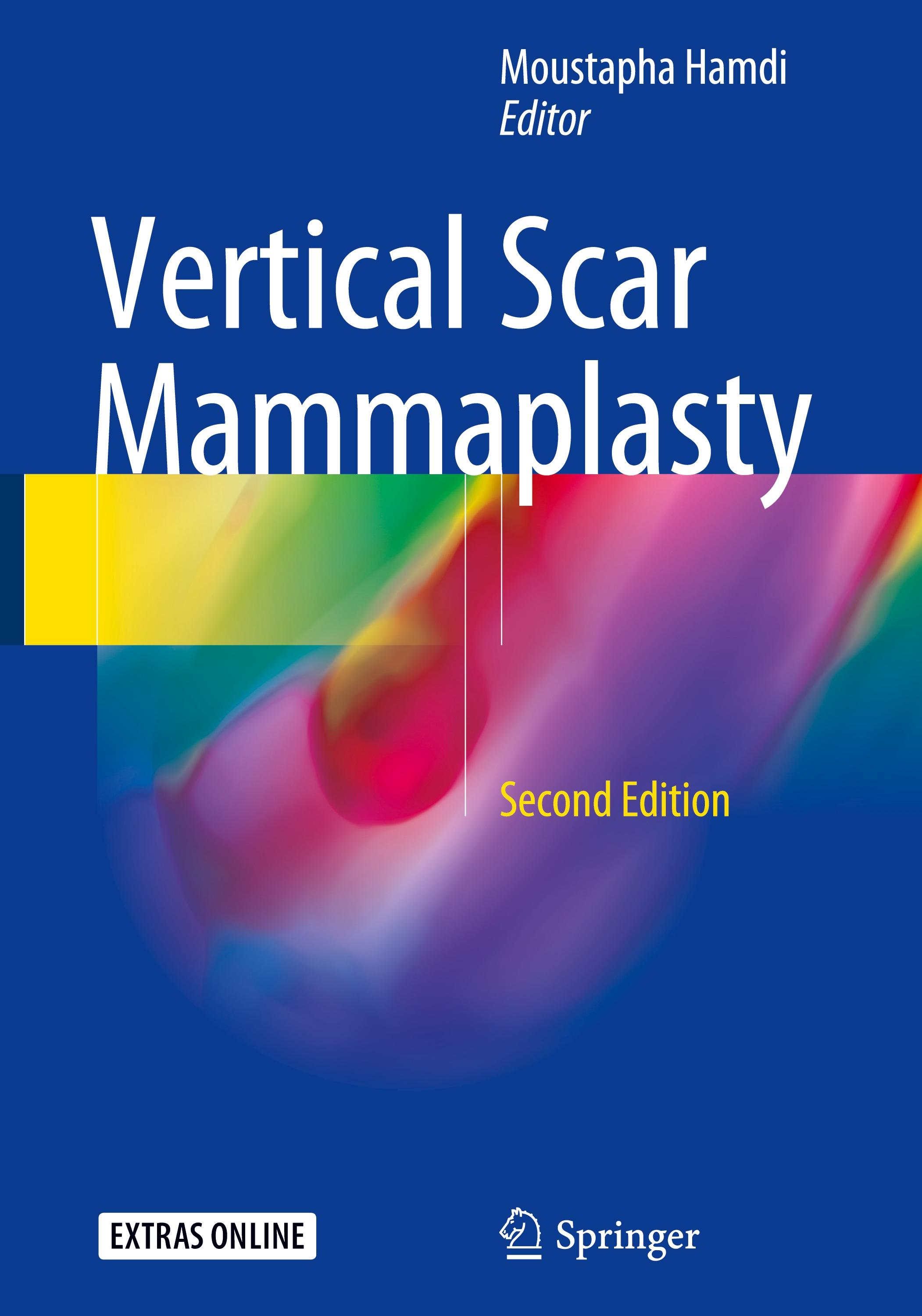 Vertical Scar Mammaplasty