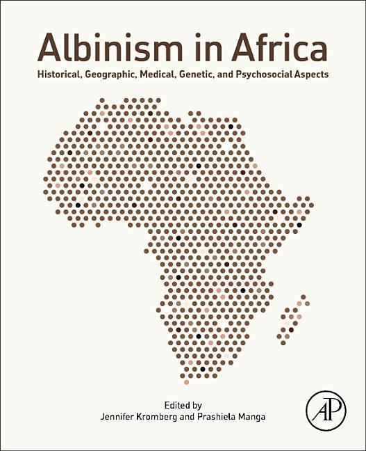 Albinism in Africa