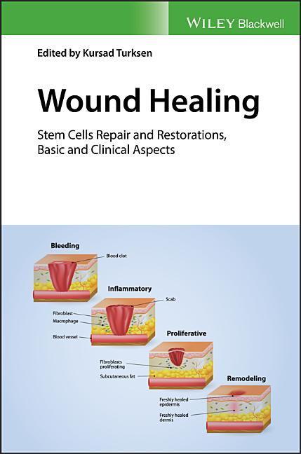 Wound Healing