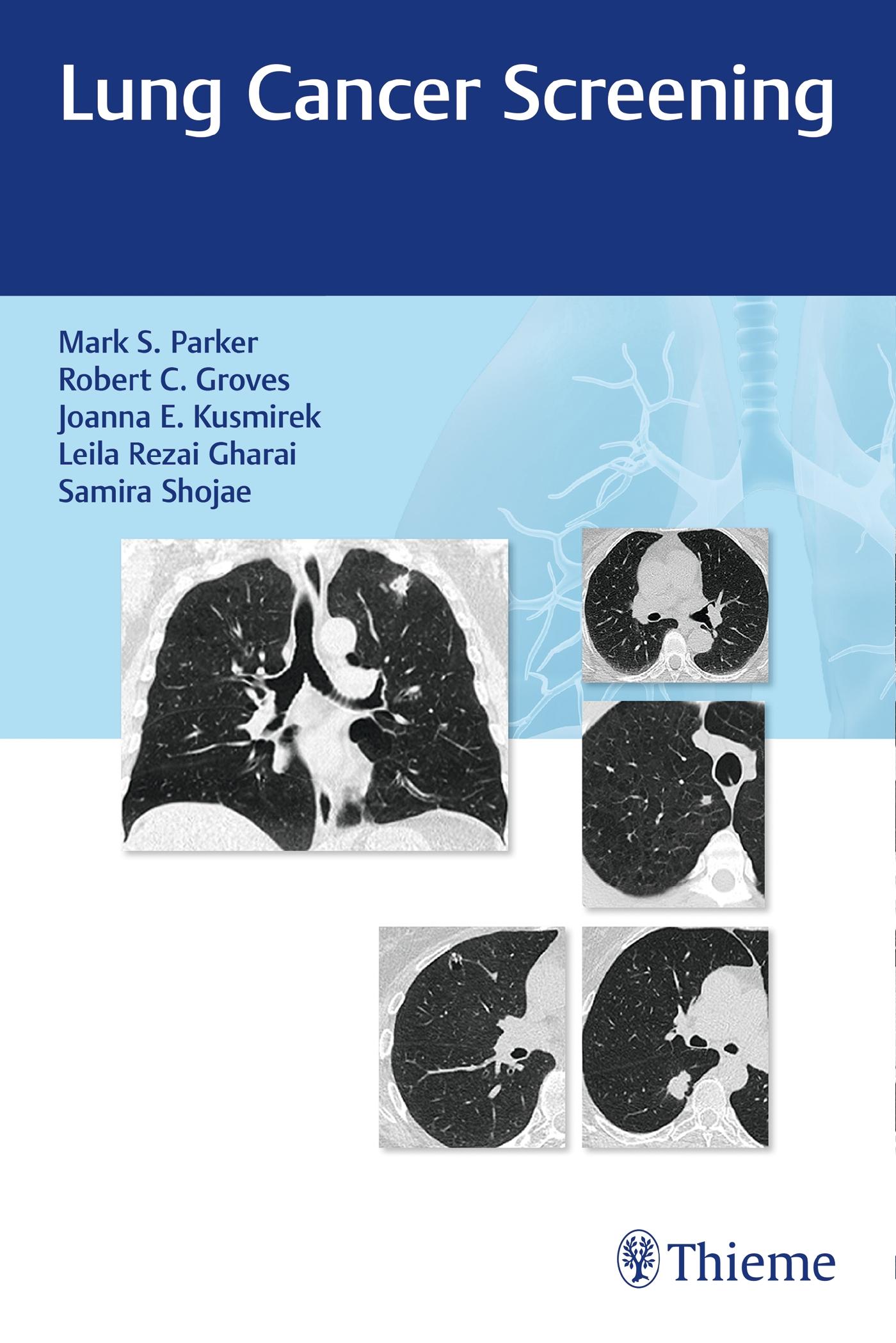 Lung Cancer Screening