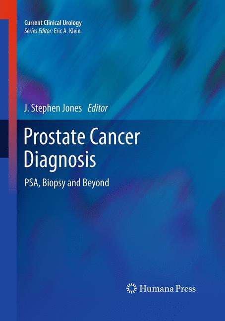 Prostate Cancer Diagnosis