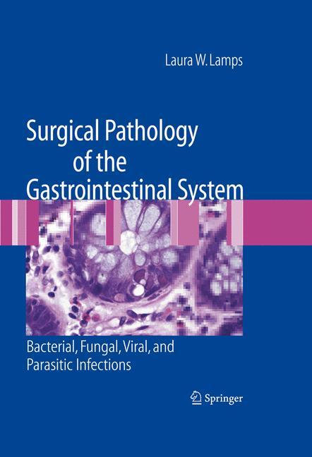 Surgical Pathology of the Gastrointestinal System: Bacterial, Fungal, Viral, and Parasitic Infections