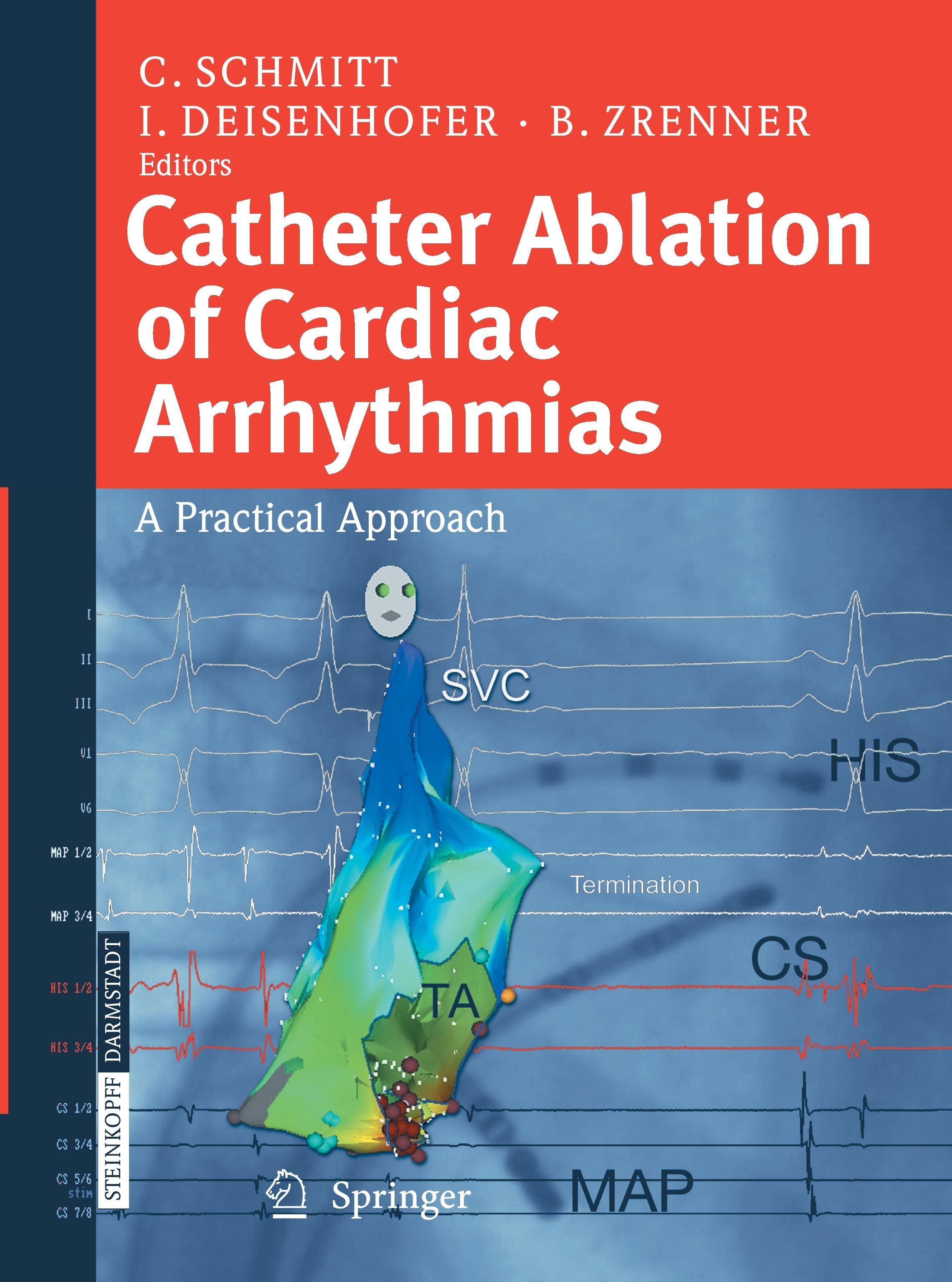 Catheter Ablation of Cardiac Arrhythmias