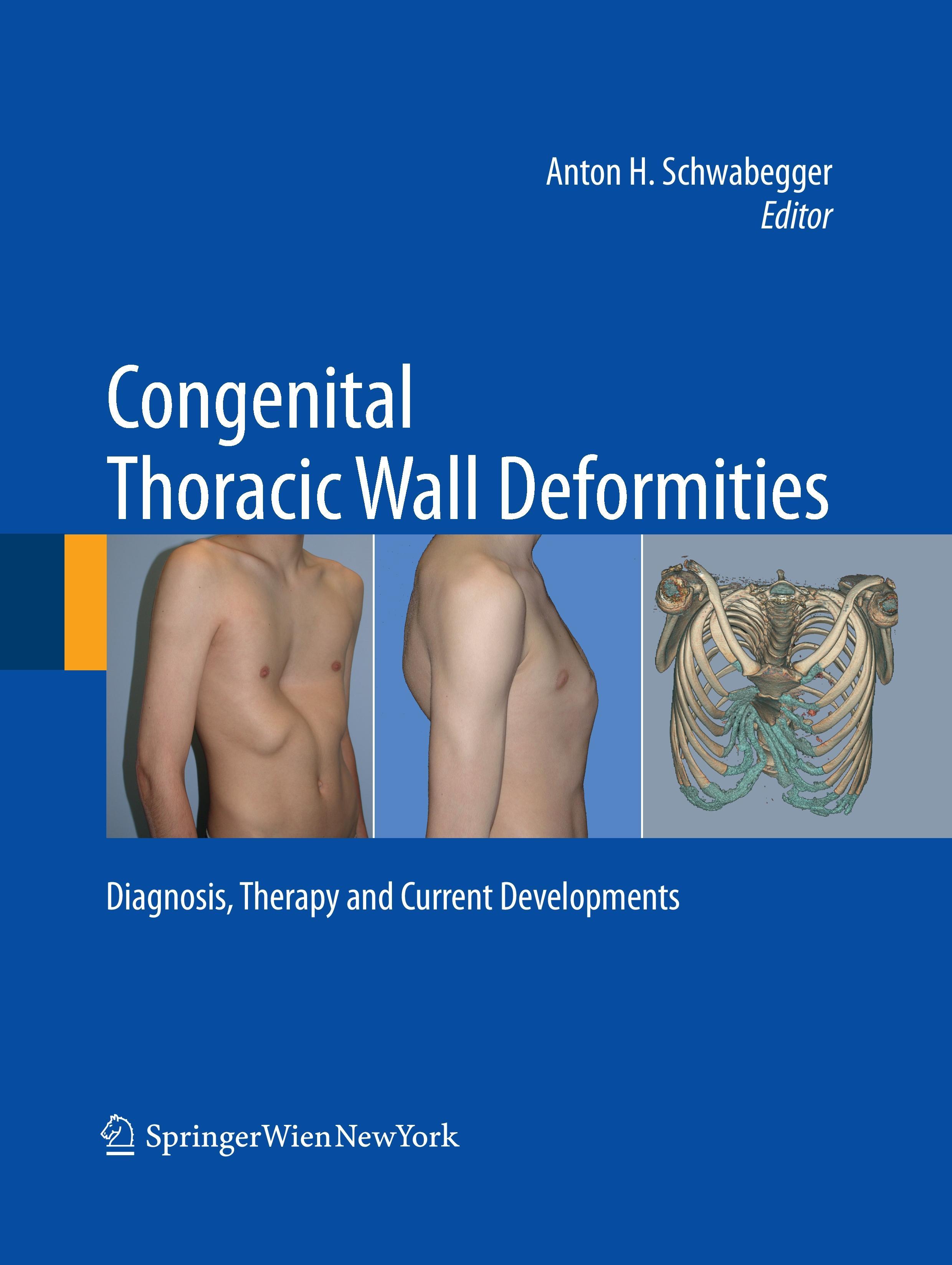 Congenital Thoracic Wall Deformities