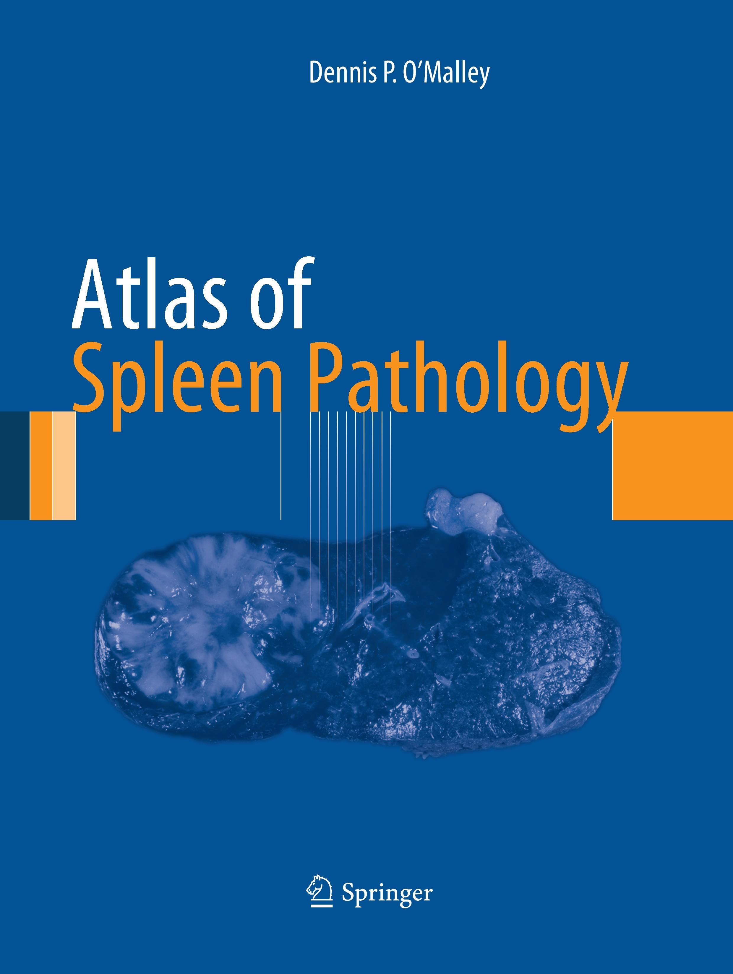 Atlas of Spleen Pathology