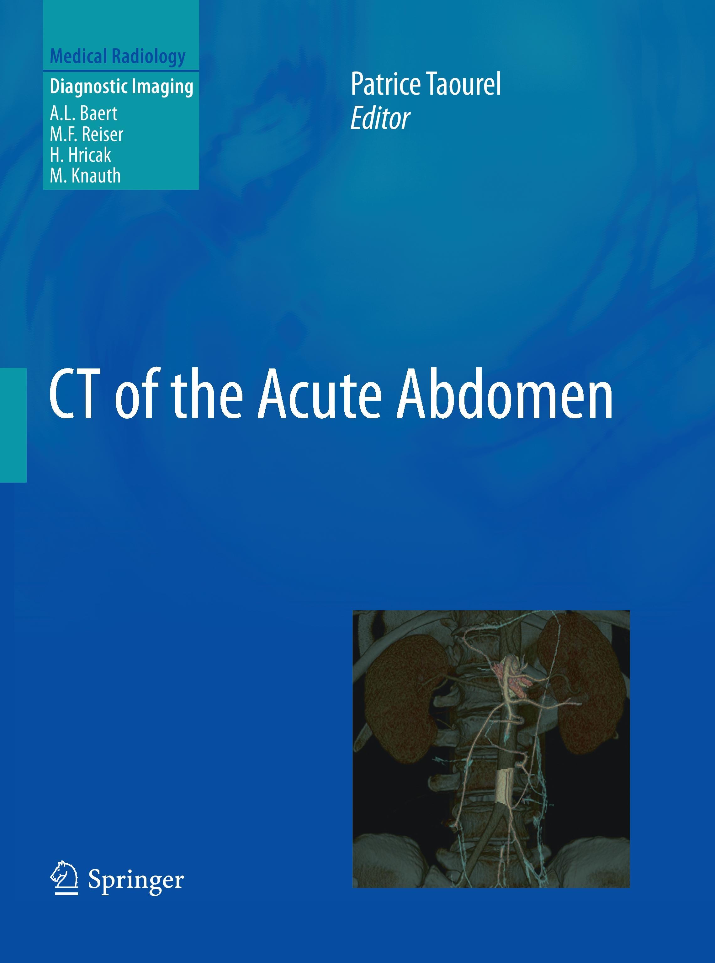 CT of the Acute Abdomen