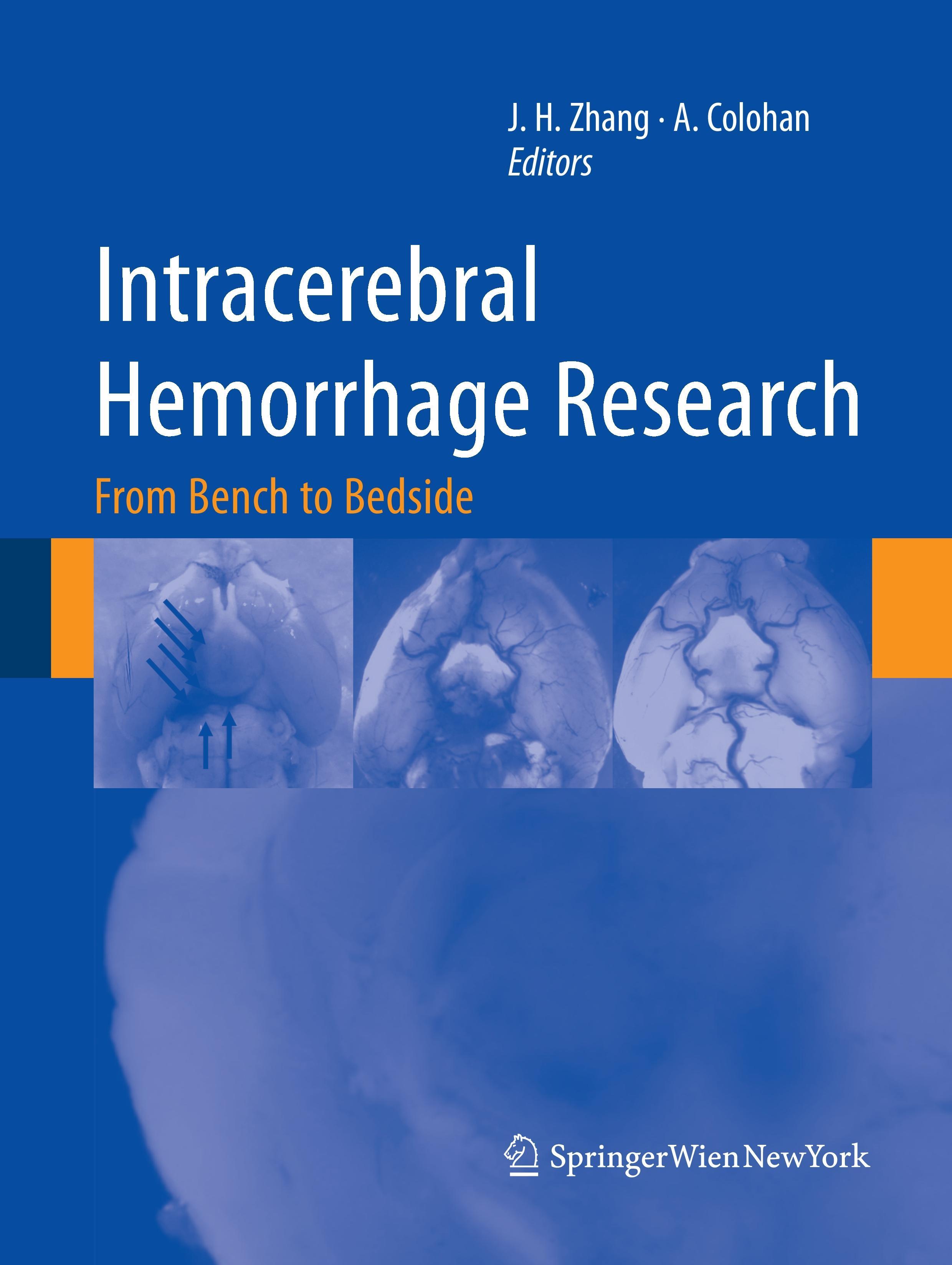 Intracerebral Hemorrhage Research