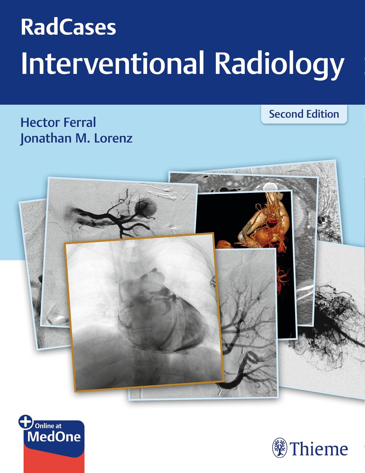 Radcases Q&A Interventional Radiology