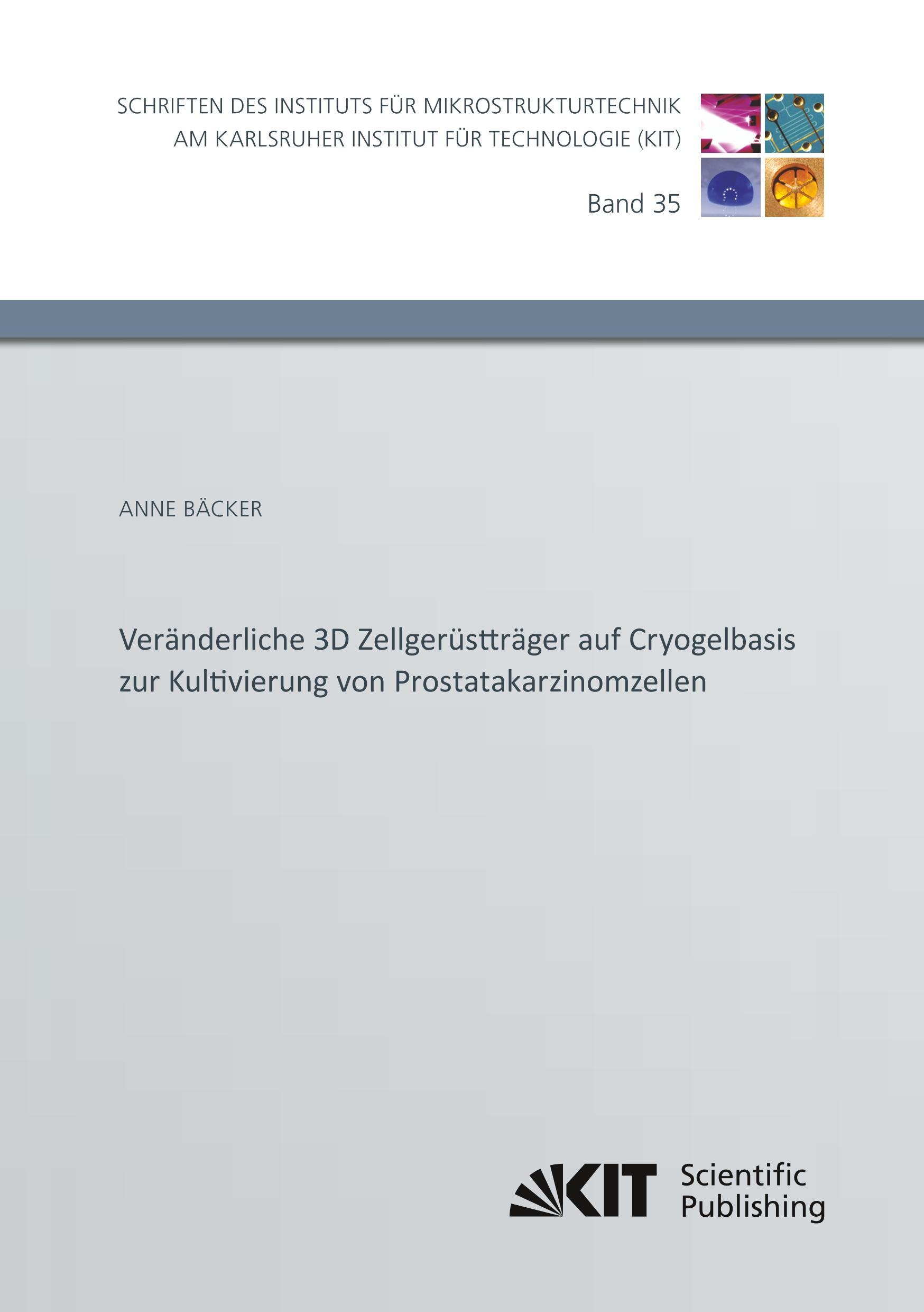 Veränderliche 3D Zellgerüstträger auf Cryogelbasis zur Kultivierung von Prostatakarzinomzellen