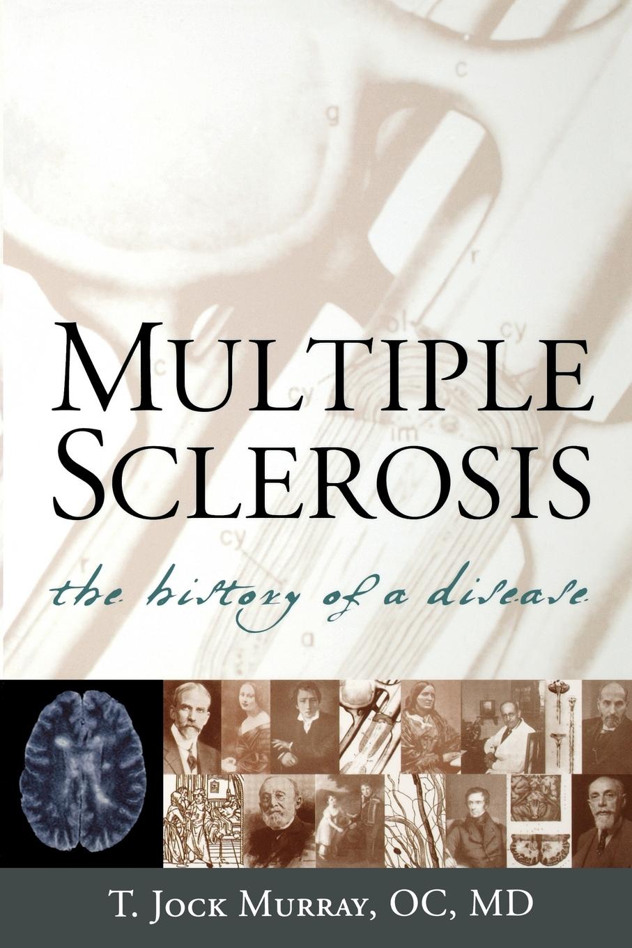 Multiple Sclerosis